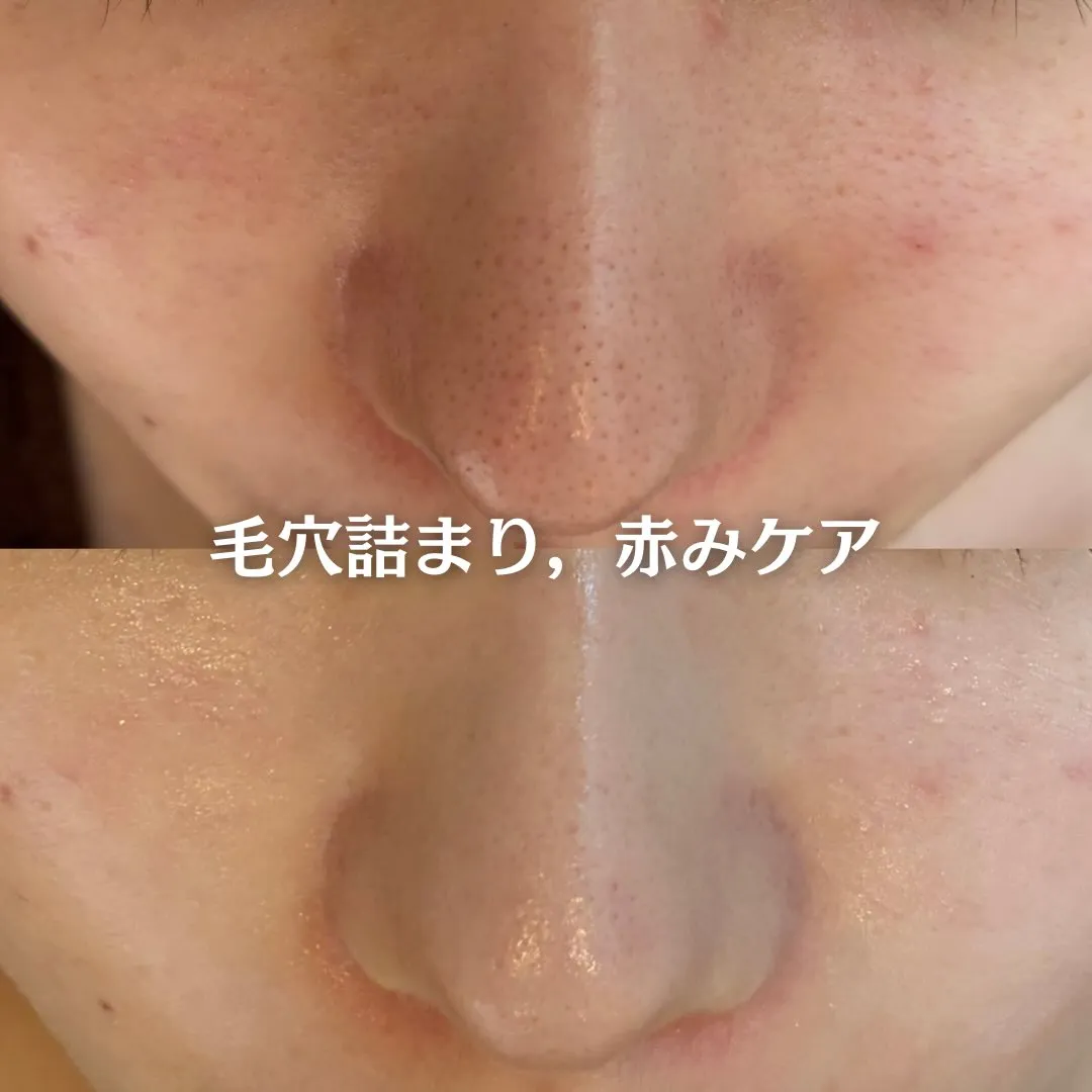 @beautysalonfacile 👈🏻他投稿もチェック