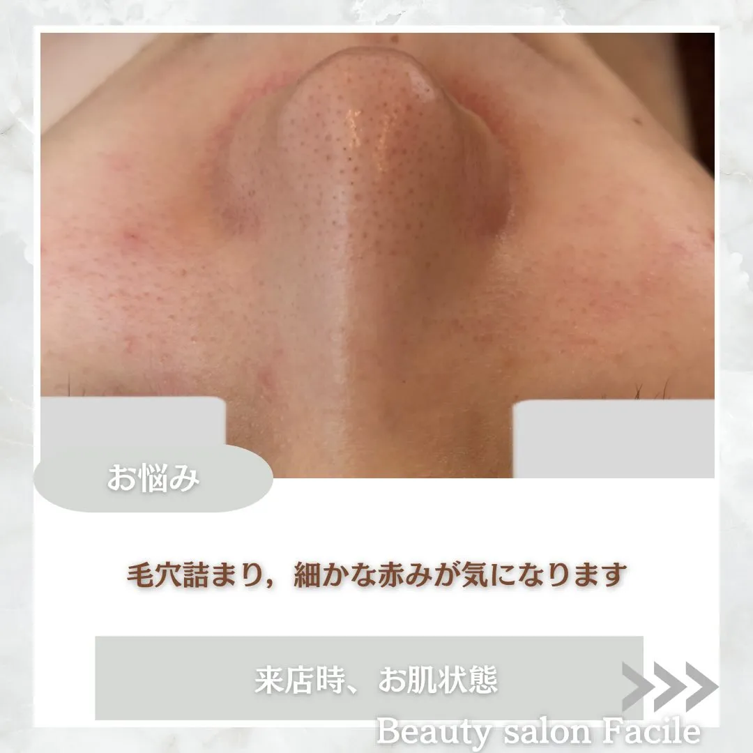 @beautysalonfacile 👈🏻他投稿もチェック