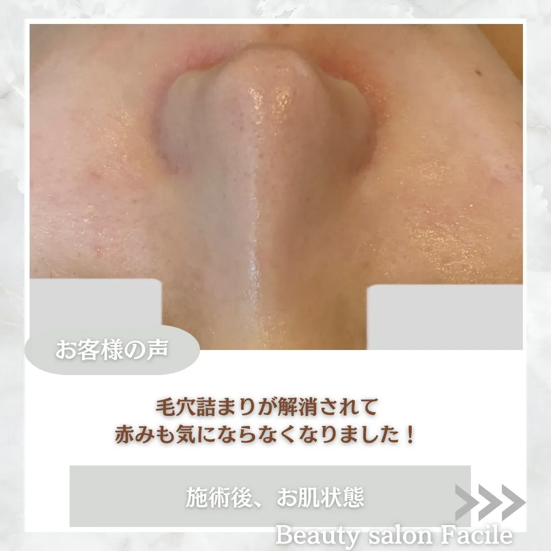 @beautysalonfacile 👈🏻他投稿もチェック