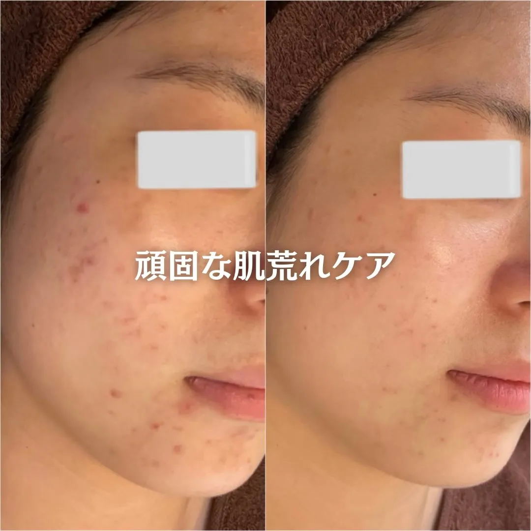 @beautysalonfacile 👈🏻他投稿もチェック
