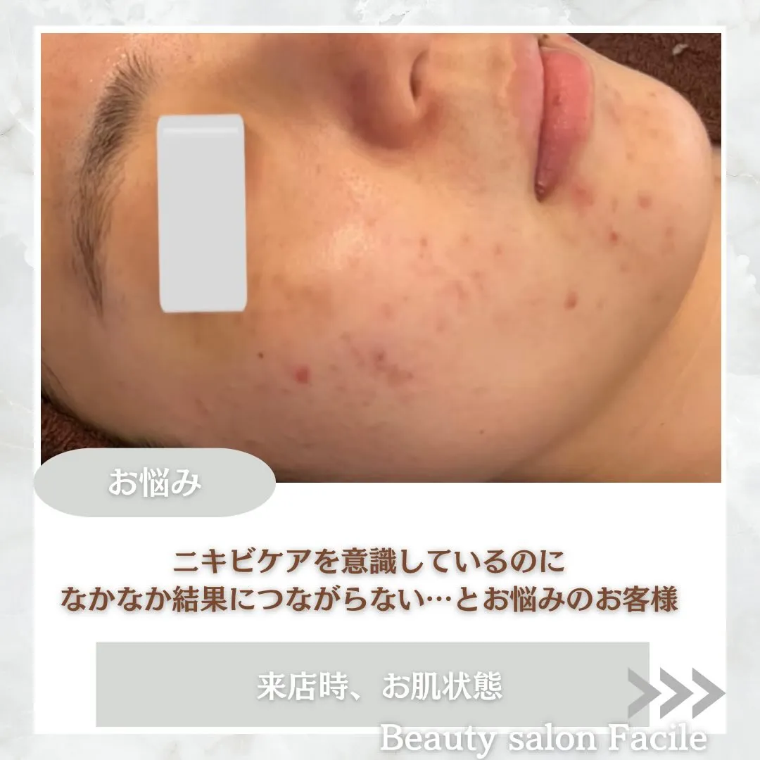 @beautysalonfacile 👈🏻他投稿もチェック