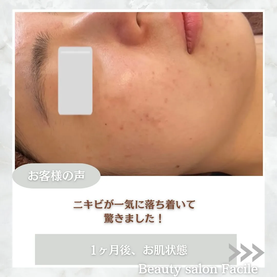 @beautysalonfacile 👈🏻他投稿もチェック