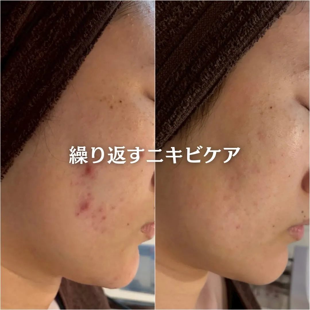 @beautysalonfacile 👈🏻他投稿もチェック