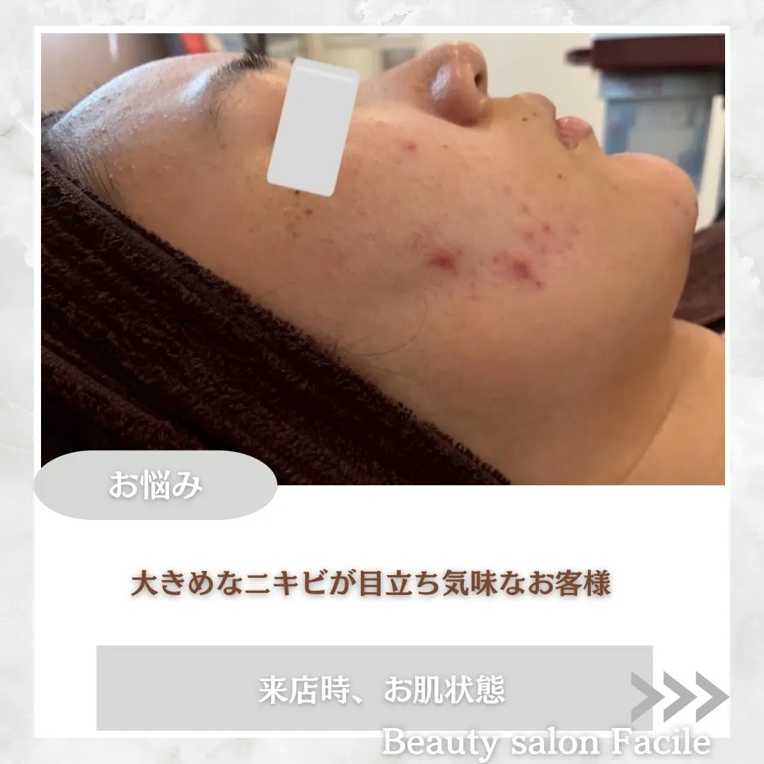 @beautysalonfacile 👈🏻他投稿もチェック