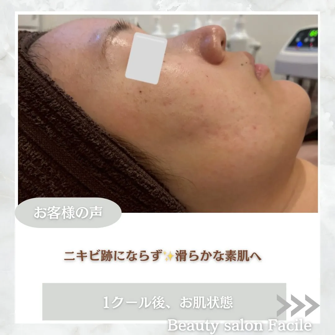 @beautysalonfacile 👈🏻他投稿もチェック