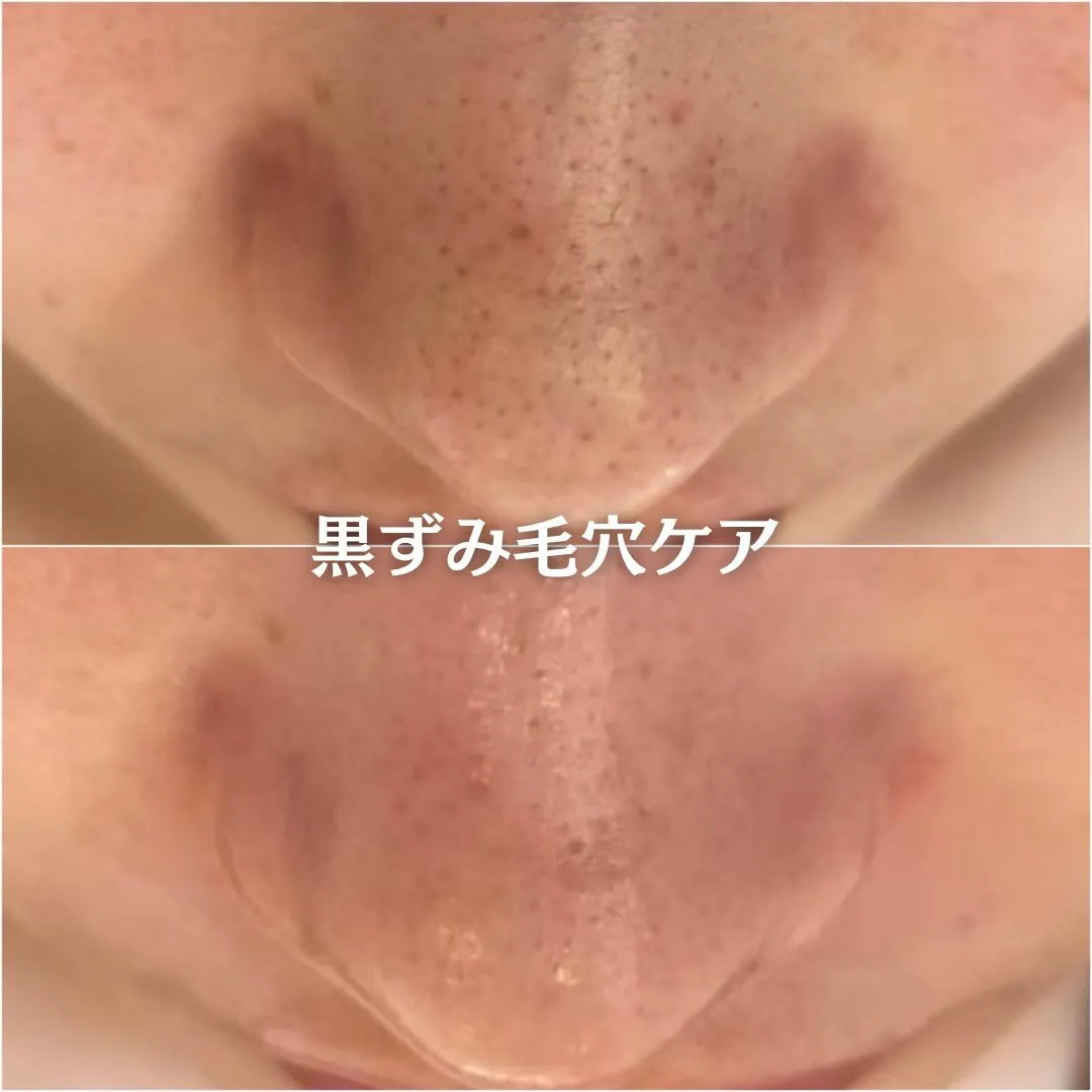 @beautysalonfacile 👈🏻他投稿もチェック