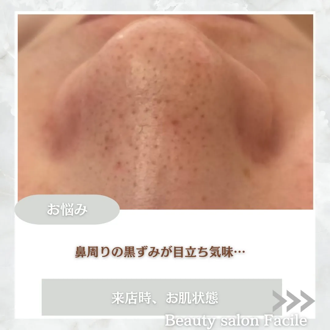 @beautysalonfacile 👈🏻他投稿もチェック