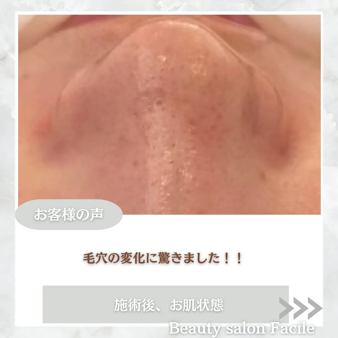 @beautysalonfacile 👈🏻他投稿もチェック