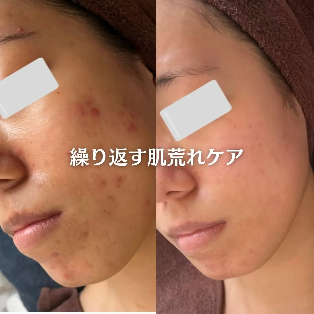 @beautysalonfacile 👈🏻他投稿もチェック