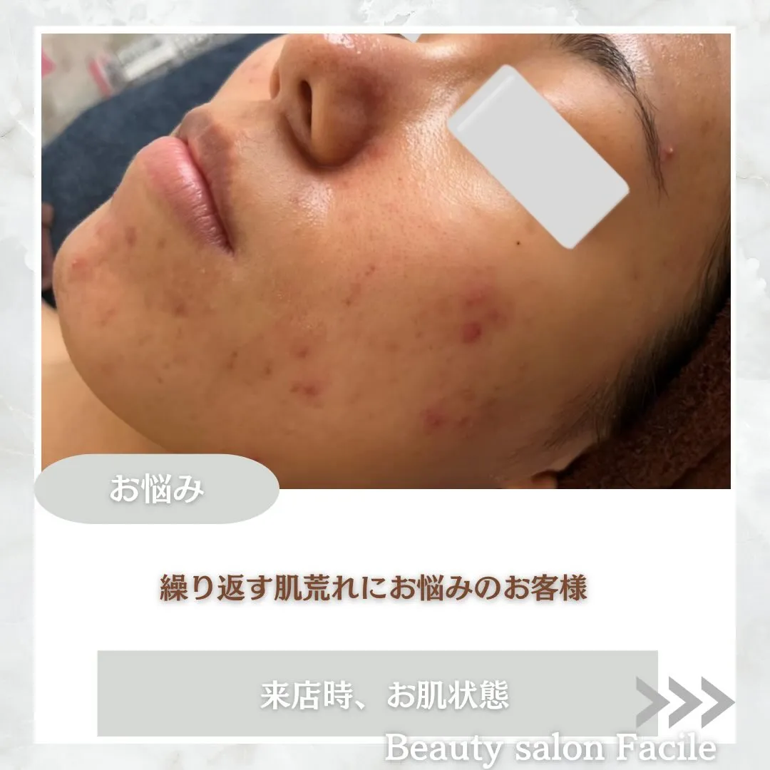 @beautysalonfacile 👈🏻他投稿もチェック