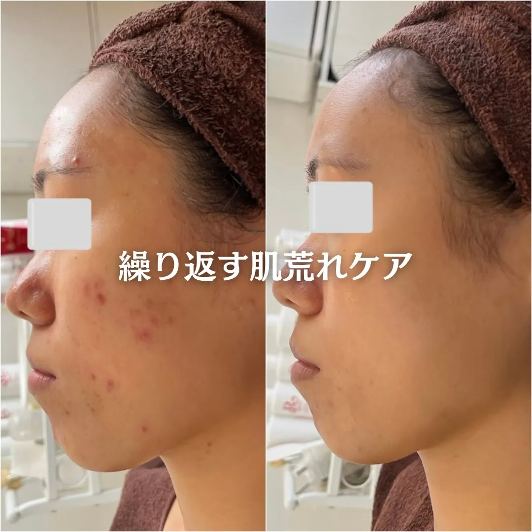 @beautysalonfacile 👈🏻他投稿もチェック