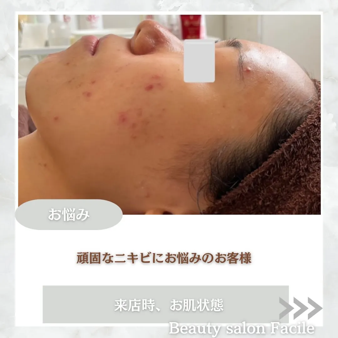 @beautysalonfacile 👈🏻他投稿もチェック
