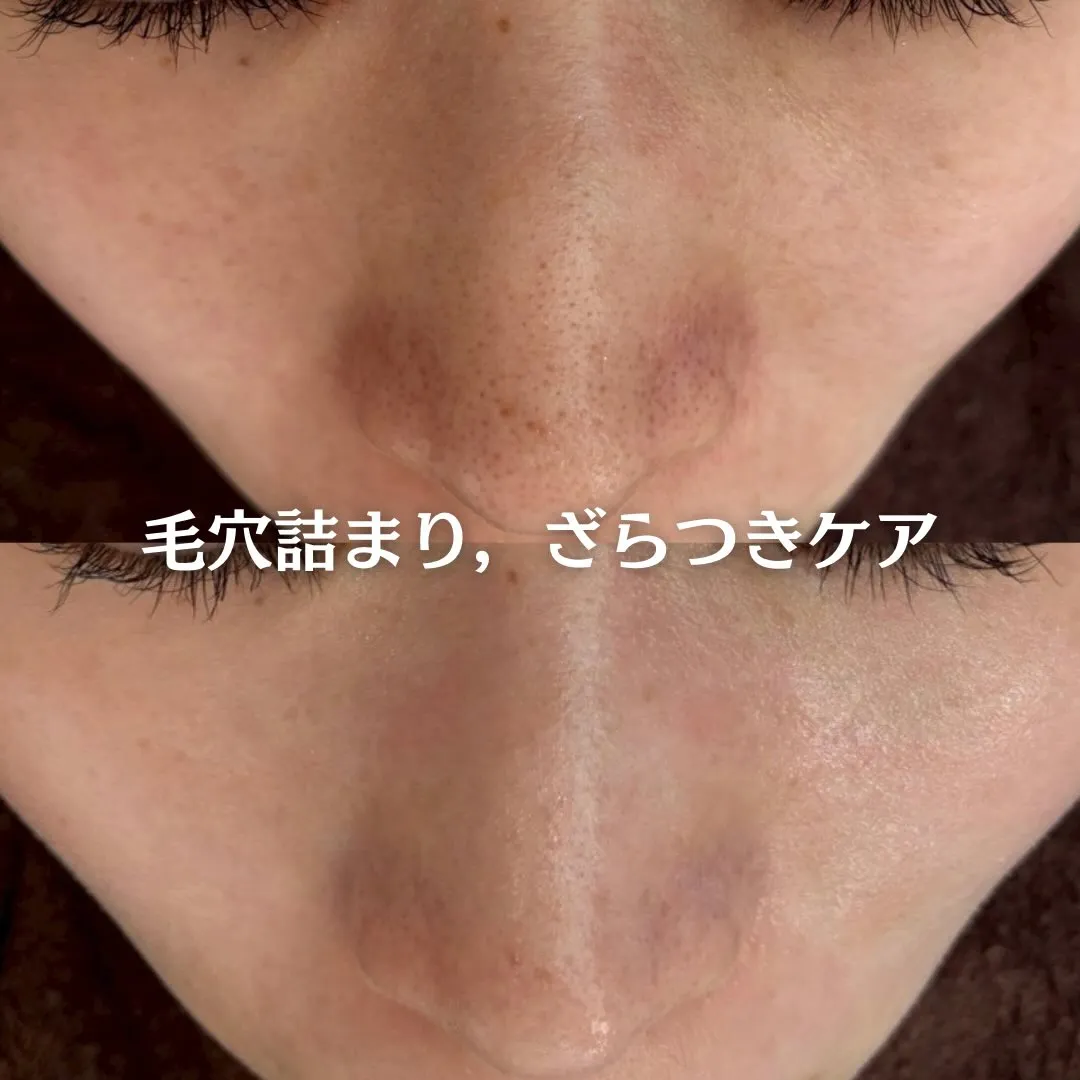 @beautysalonfacile 👈🏻他投稿もチェック