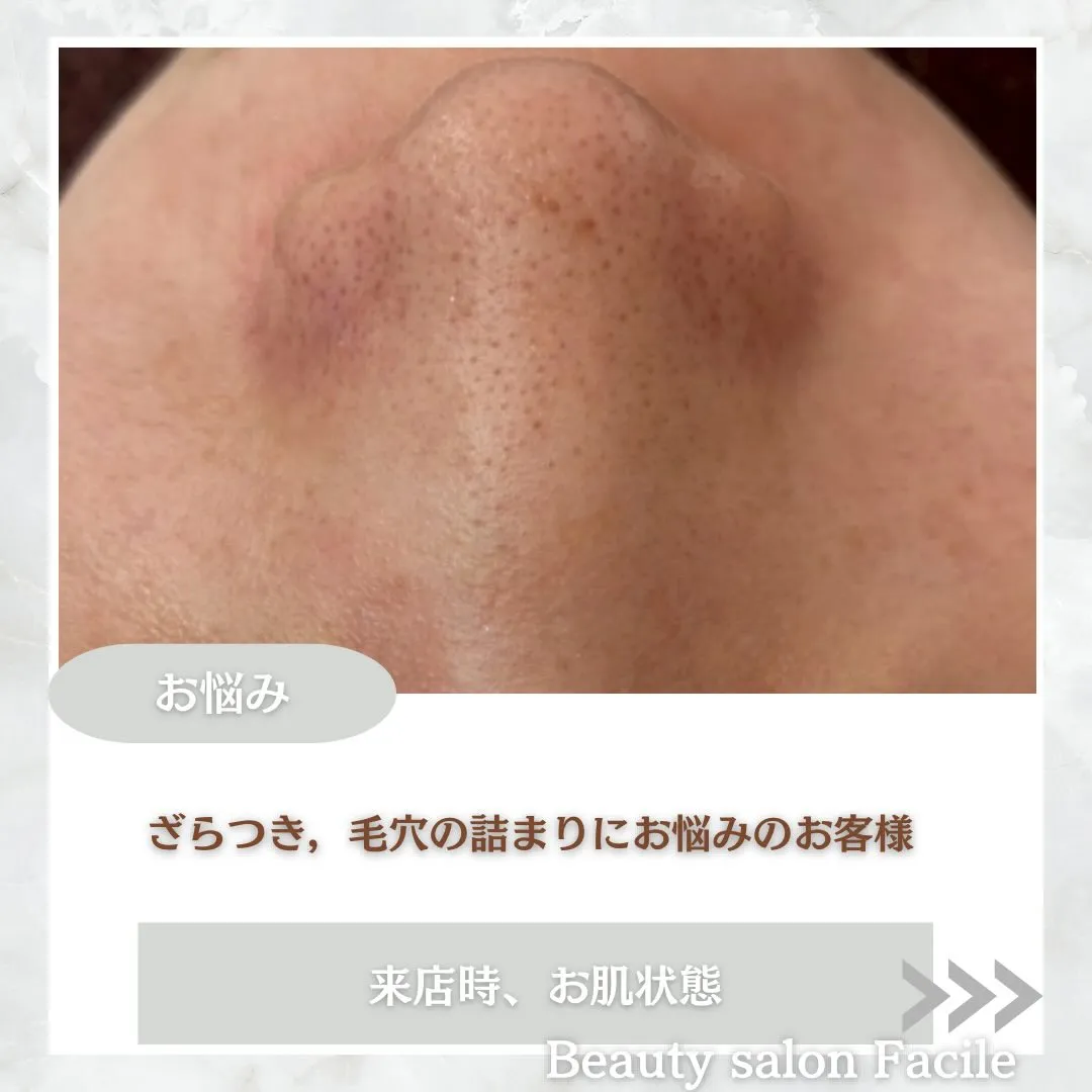 @beautysalonfacile 👈🏻他投稿もチェック