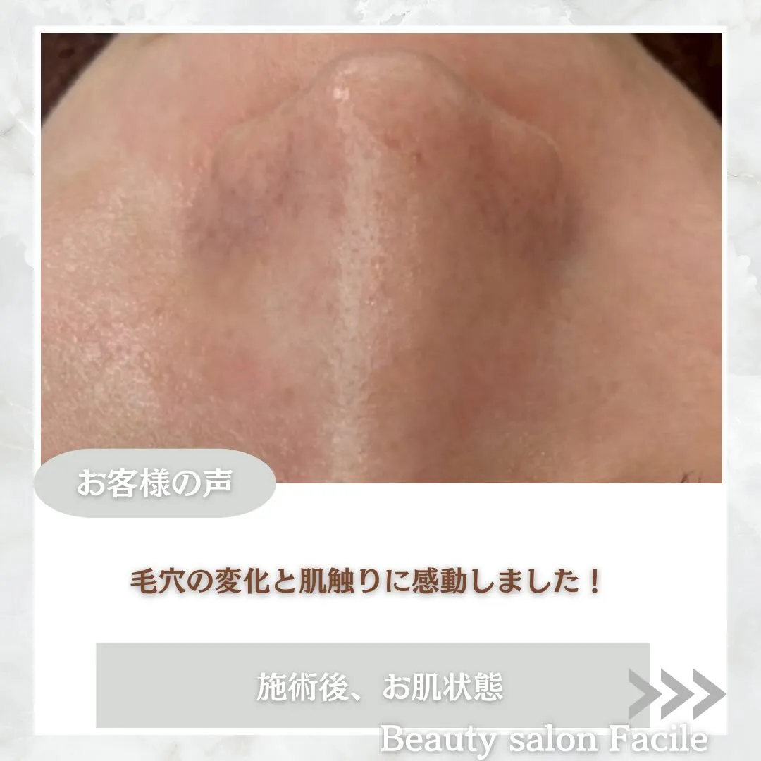 @beautysalonfacile 👈🏻他投稿もチェック