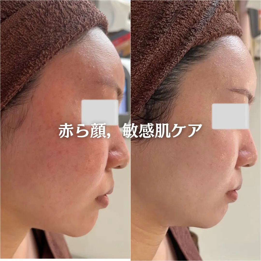 @beautysalonfacile 👈🏻他投稿もチェック