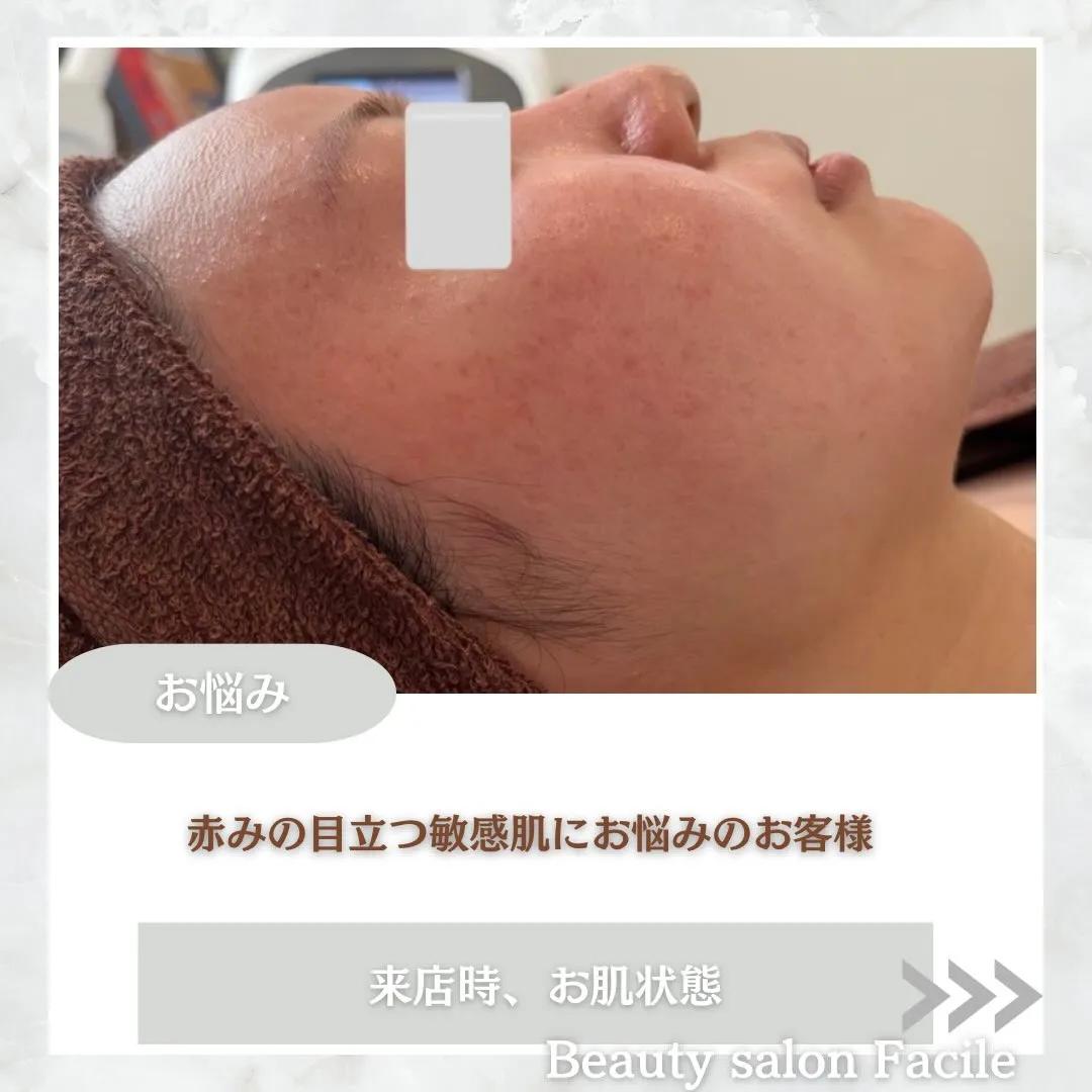 @beautysalonfacile 👈🏻他投稿もチェック