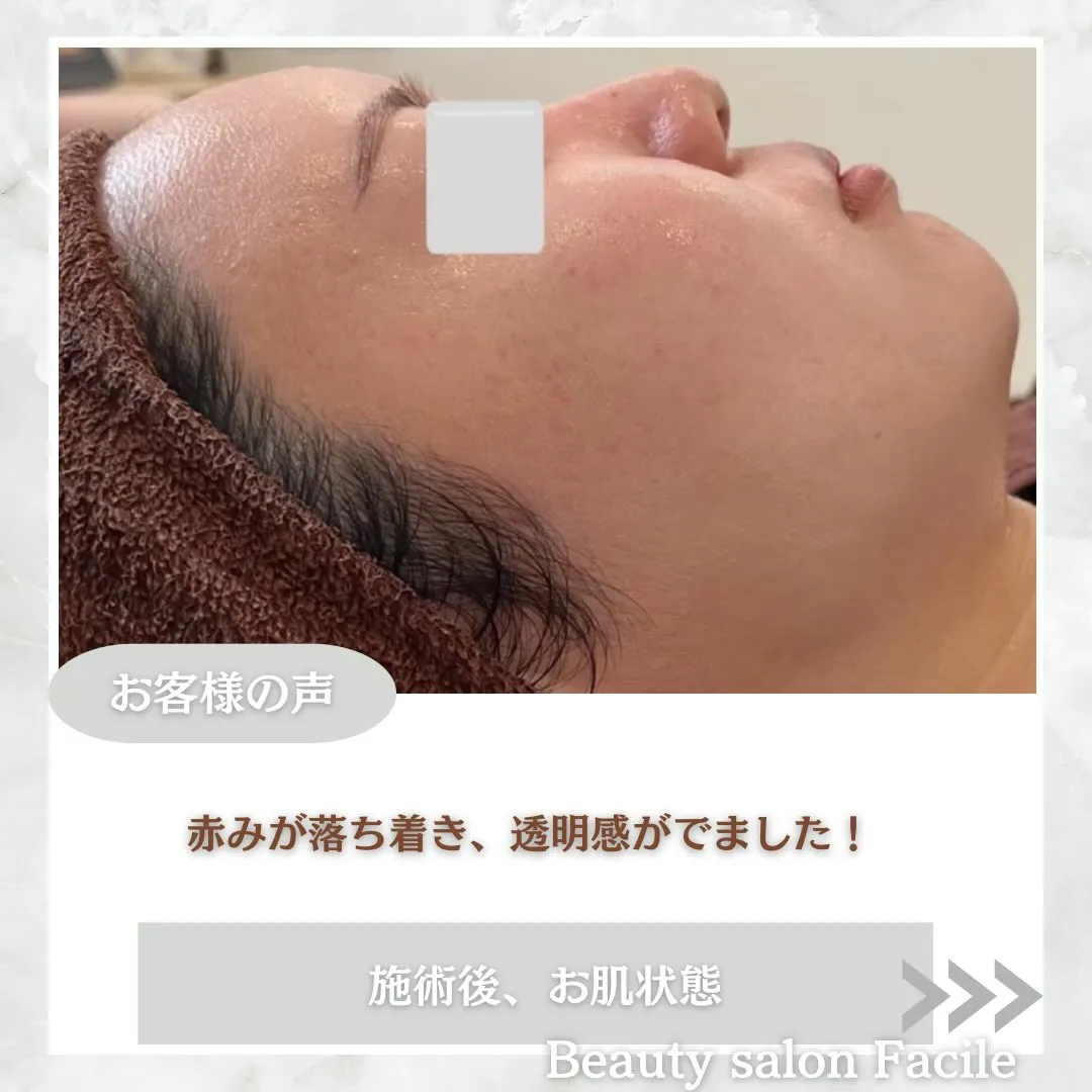 @beautysalonfacile 👈🏻他投稿もチェック
