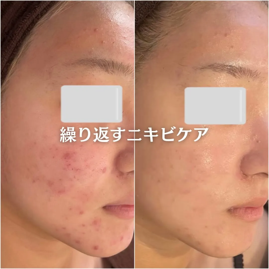 @beautysalonfacile 👈🏻他投稿もチェック