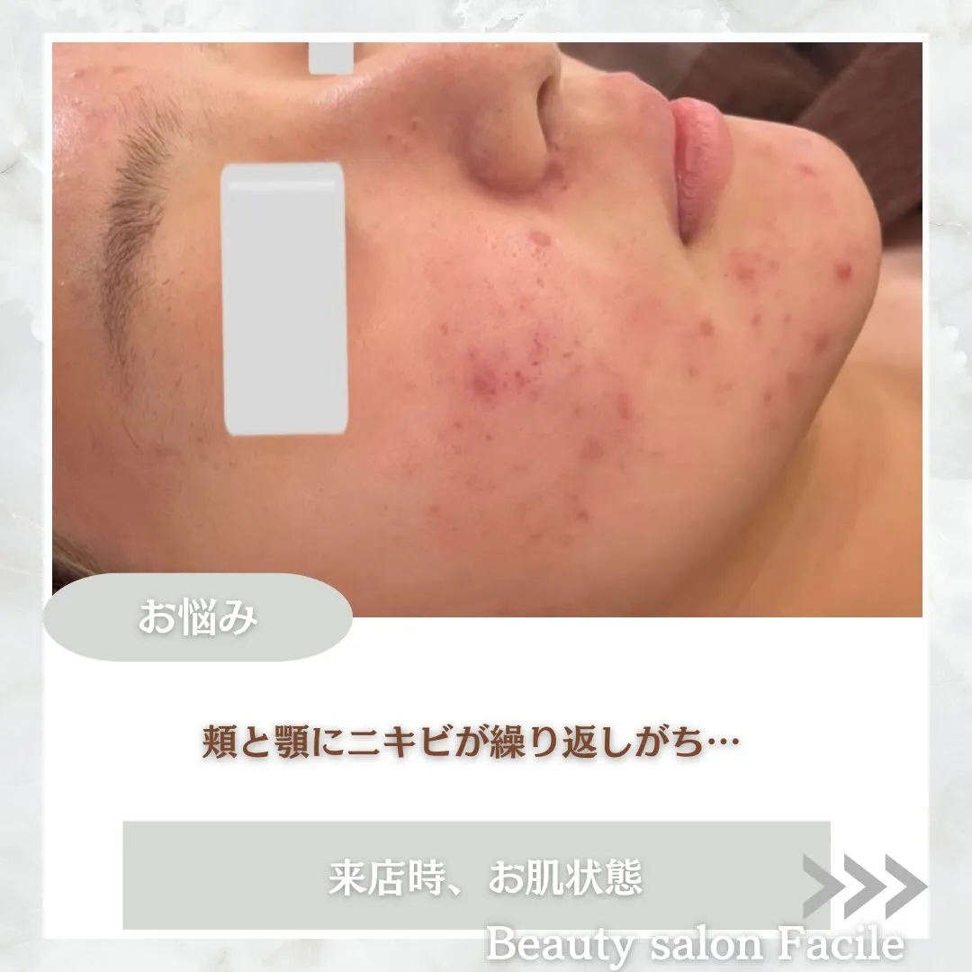 @beautysalonfacile 👈🏻他投稿もチェック