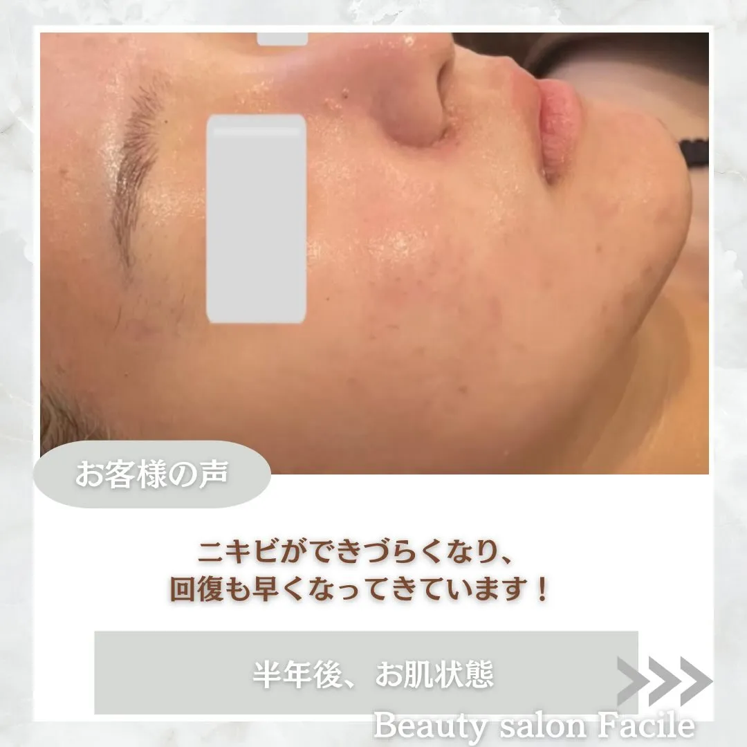 @beautysalonfacile 👈🏻他投稿もチェック
