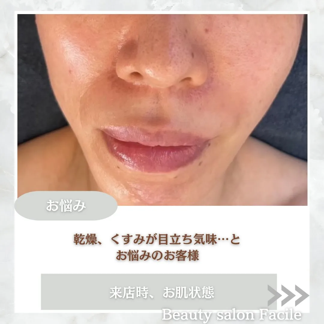 @beautysalonfacile 👈🏻他投稿もチェック