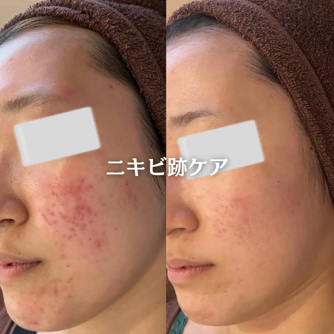 @beautysalonfacile 👈🏻他投稿もチェック