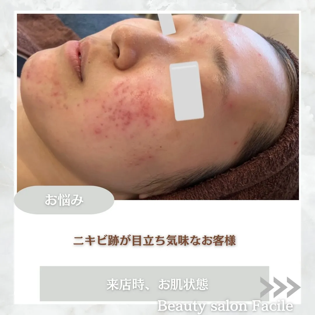 @beautysalonfacile 👈🏻他投稿もチェック