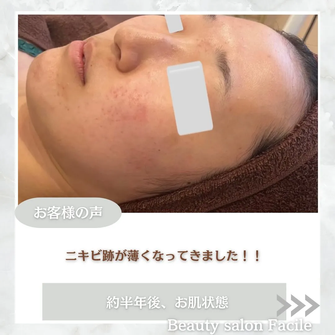 @beautysalonfacile 👈🏻他投稿もチェック