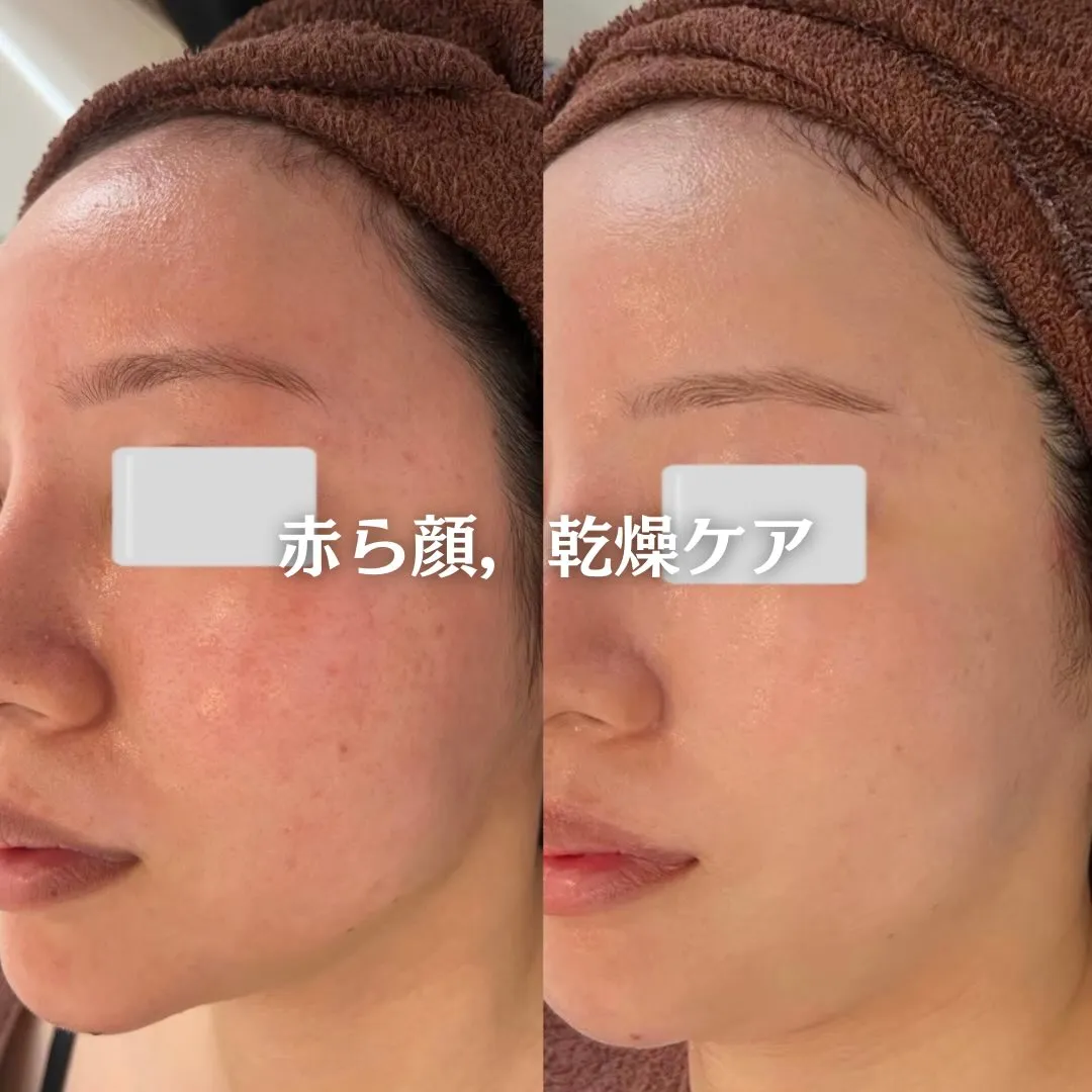 @beautysalonfacile 👈🏻他投稿もチェック