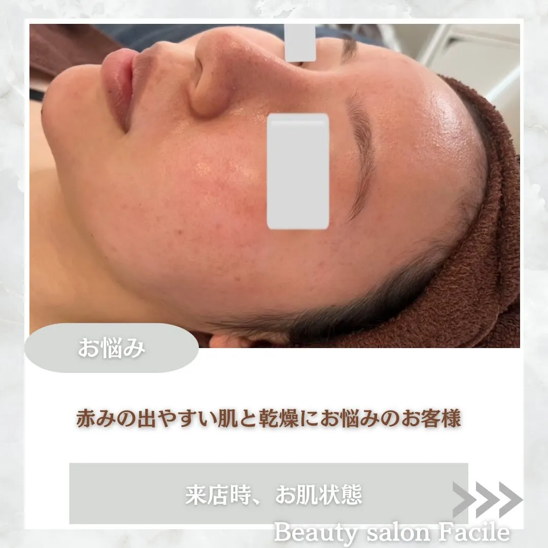 @beautysalonfacile 👈🏻他投稿もチェック