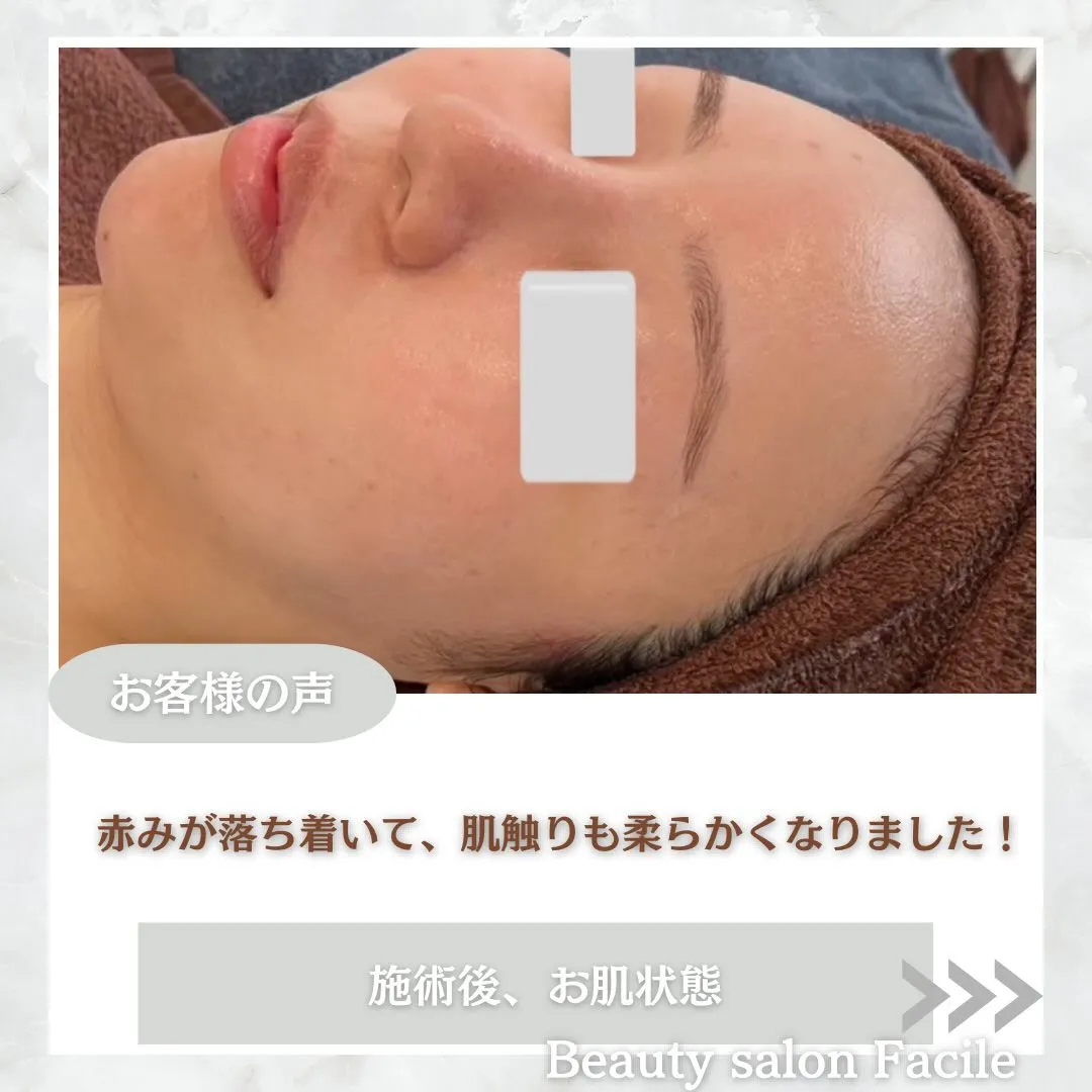 @beautysalonfacile 👈🏻他投稿もチェック