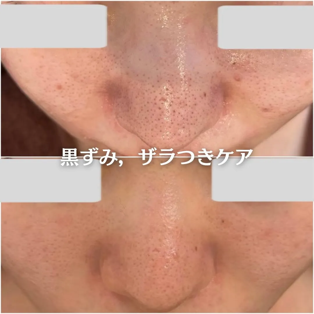 @beautysalonfacile 👈🏻他投稿もチェック