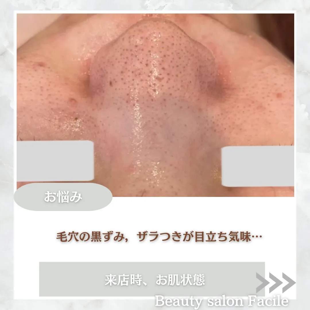 @beautysalonfacile 👈🏻他投稿もチェック