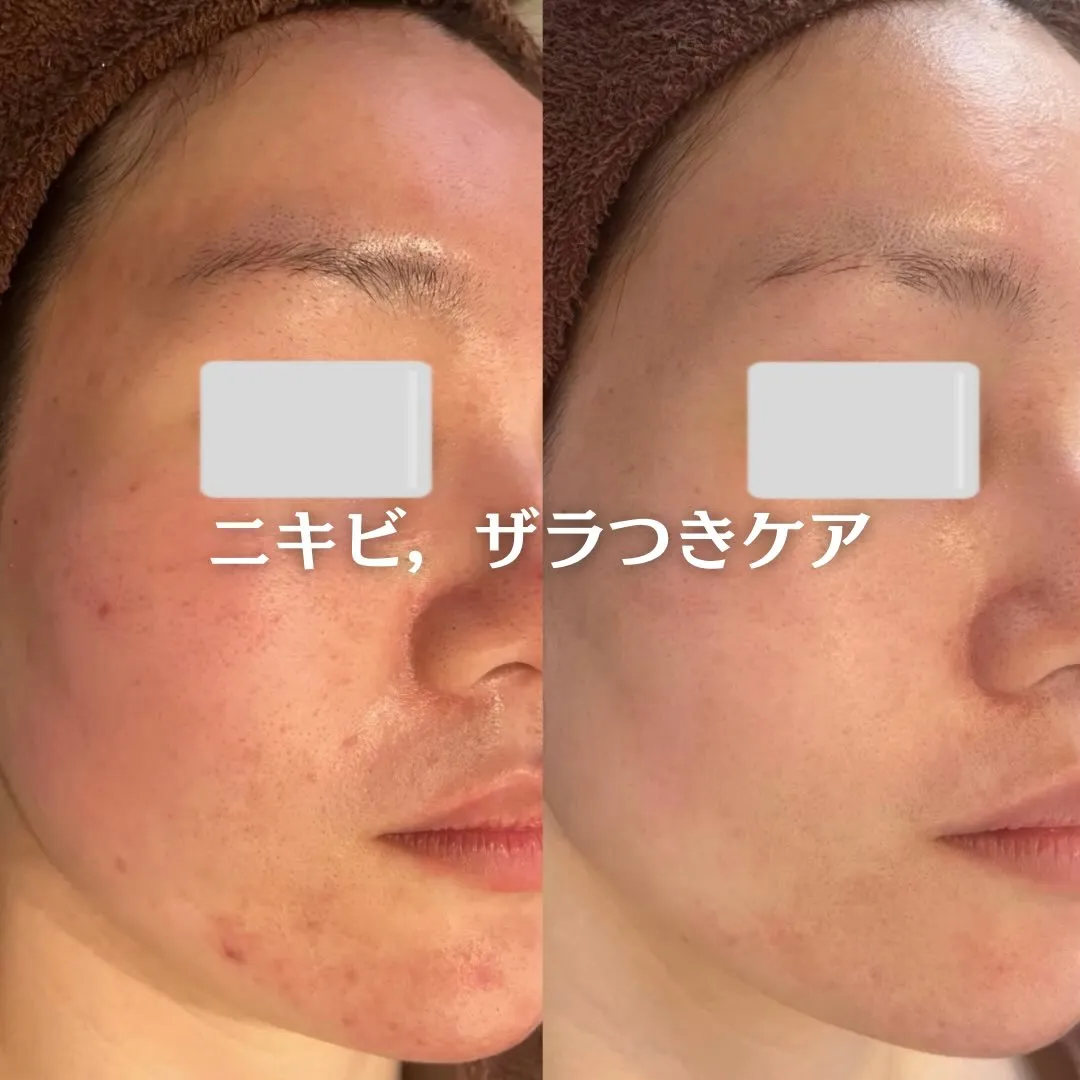 @beautysalonfacile 👈🏻他投稿もチェック