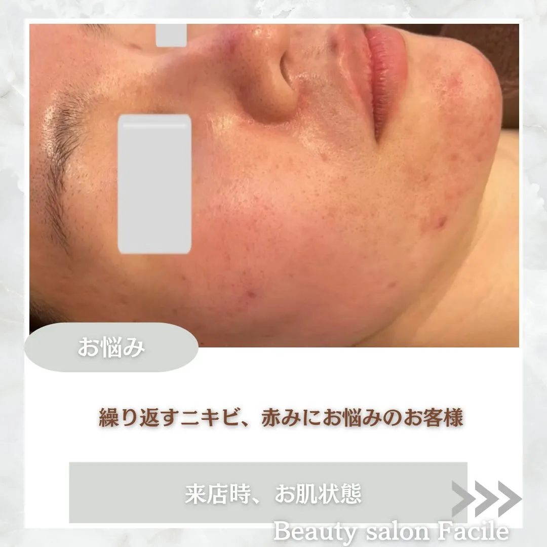 @beautysalonfacile 👈🏻他投稿もチェック