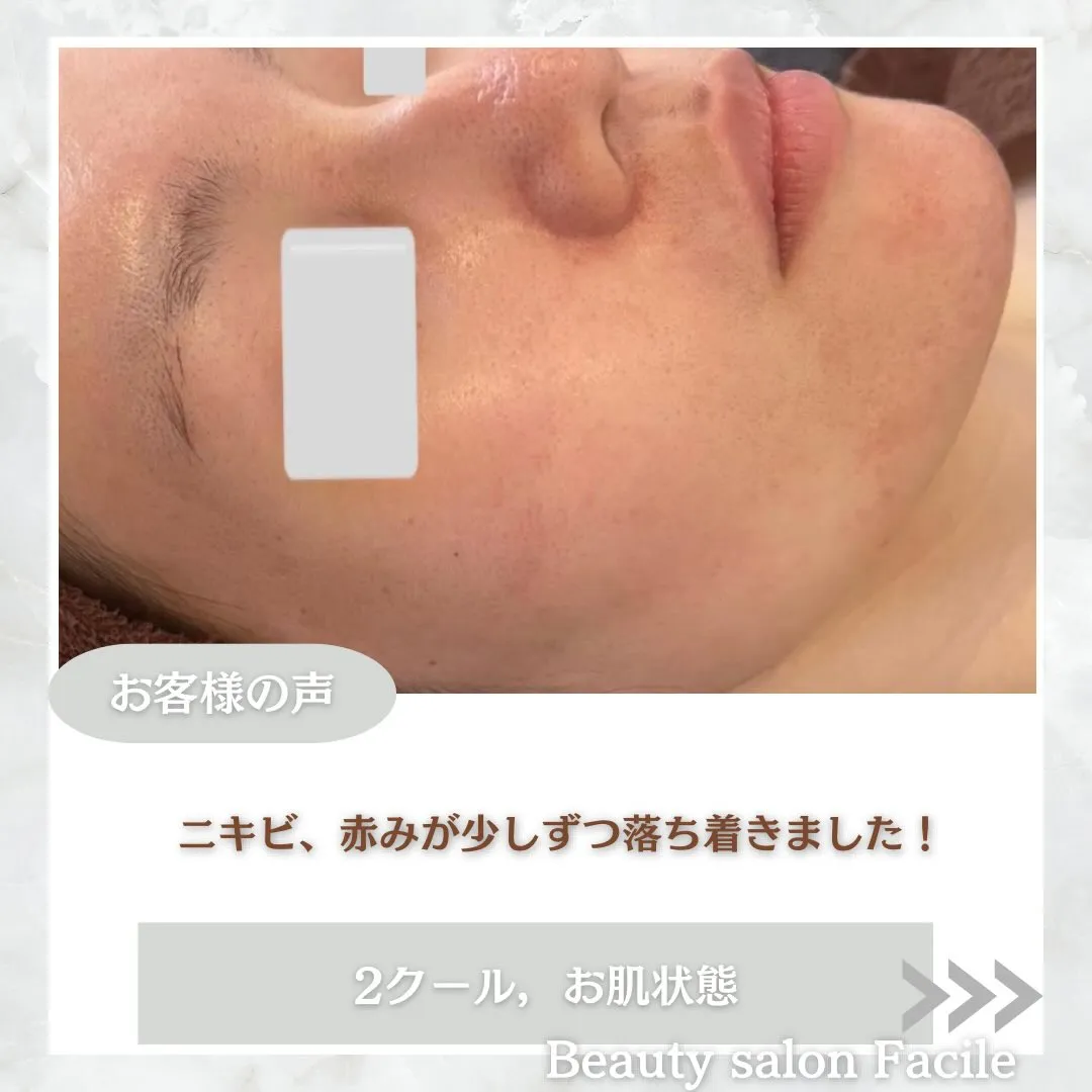 @beautysalonfacile 👈🏻他投稿もチェック