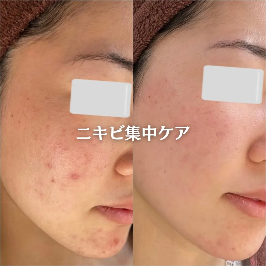 @beautysalonfacile 👈🏻他投稿もチェック