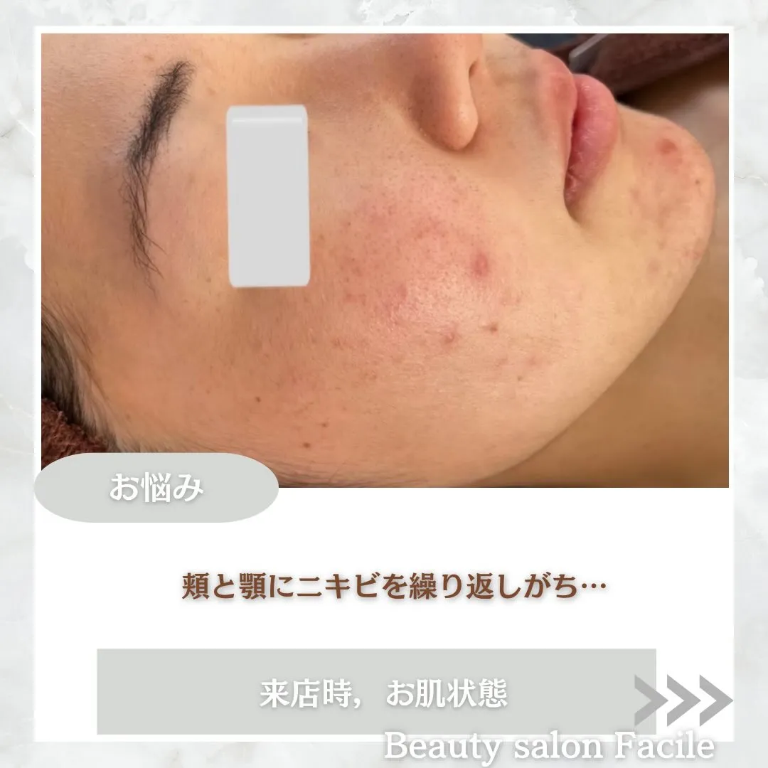 @beautysalonfacile 👈🏻他投稿もチェック