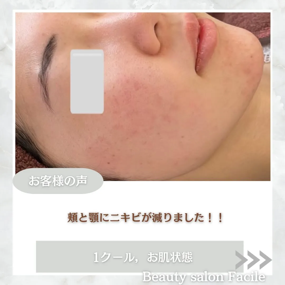 @beautysalonfacile 👈🏻他投稿もチェック