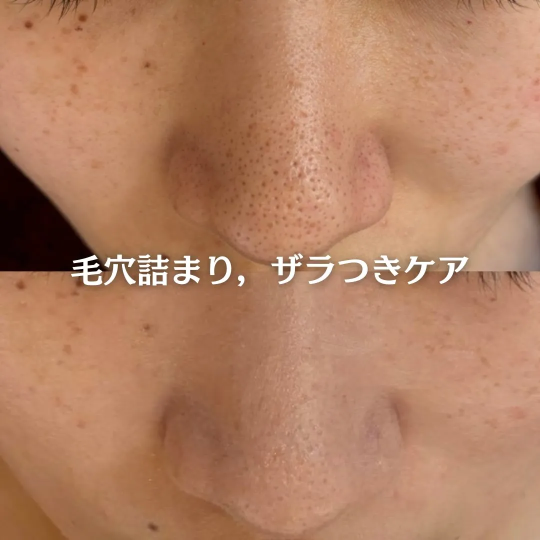 @beautysalonfacile 👈🏻他投稿もチェック