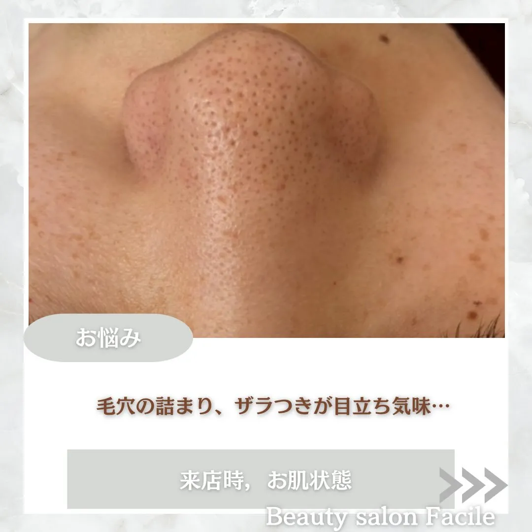 @beautysalonfacile 👈🏻他投稿もチェック