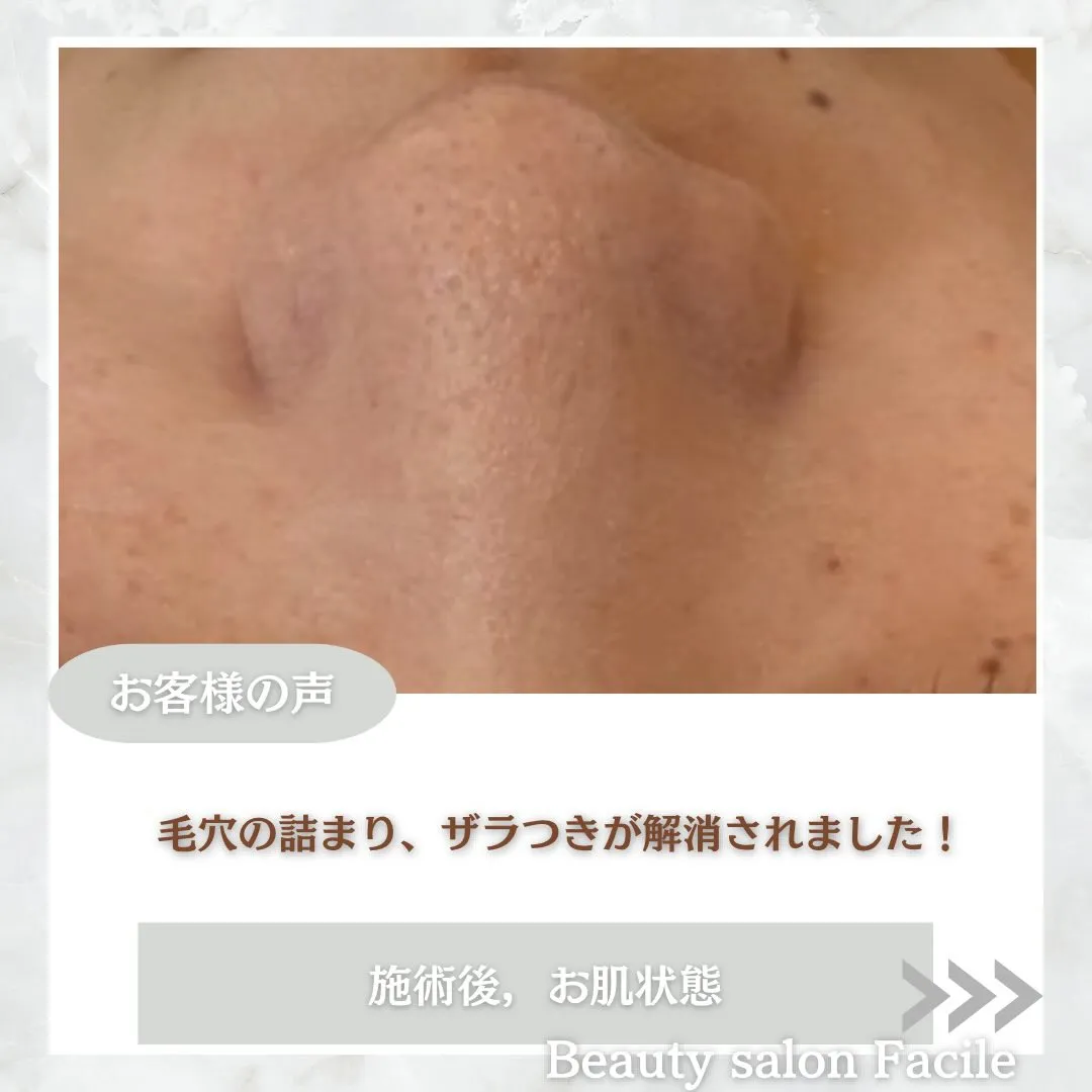 @beautysalonfacile 👈🏻他投稿もチェック