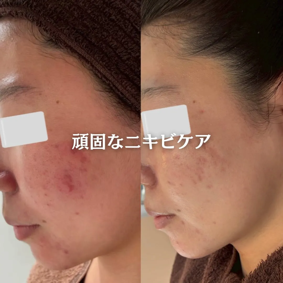 @beautysalonfacile 👈🏻他投稿もチェック