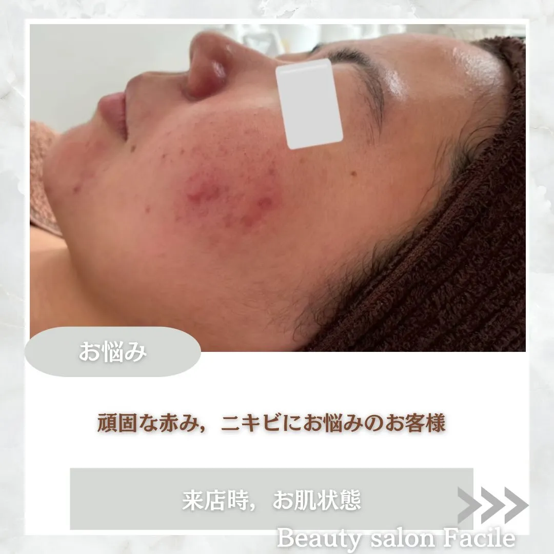 @beautysalonfacile 👈🏻他投稿もチェック
