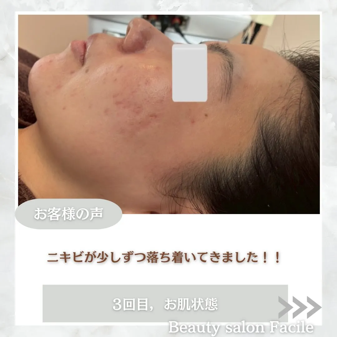 @beautysalonfacile 👈🏻他投稿もチェック