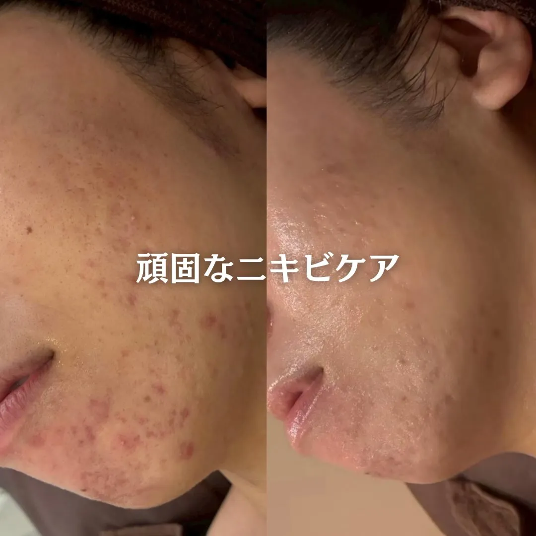 @beautysalonfacile 👈🏻他投稿もチェック