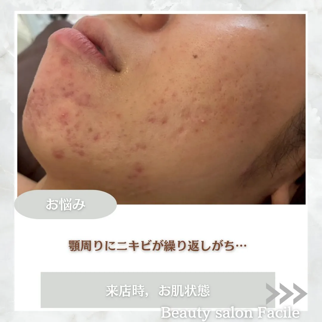 @beautysalonfacile 👈🏻他投稿もチェック