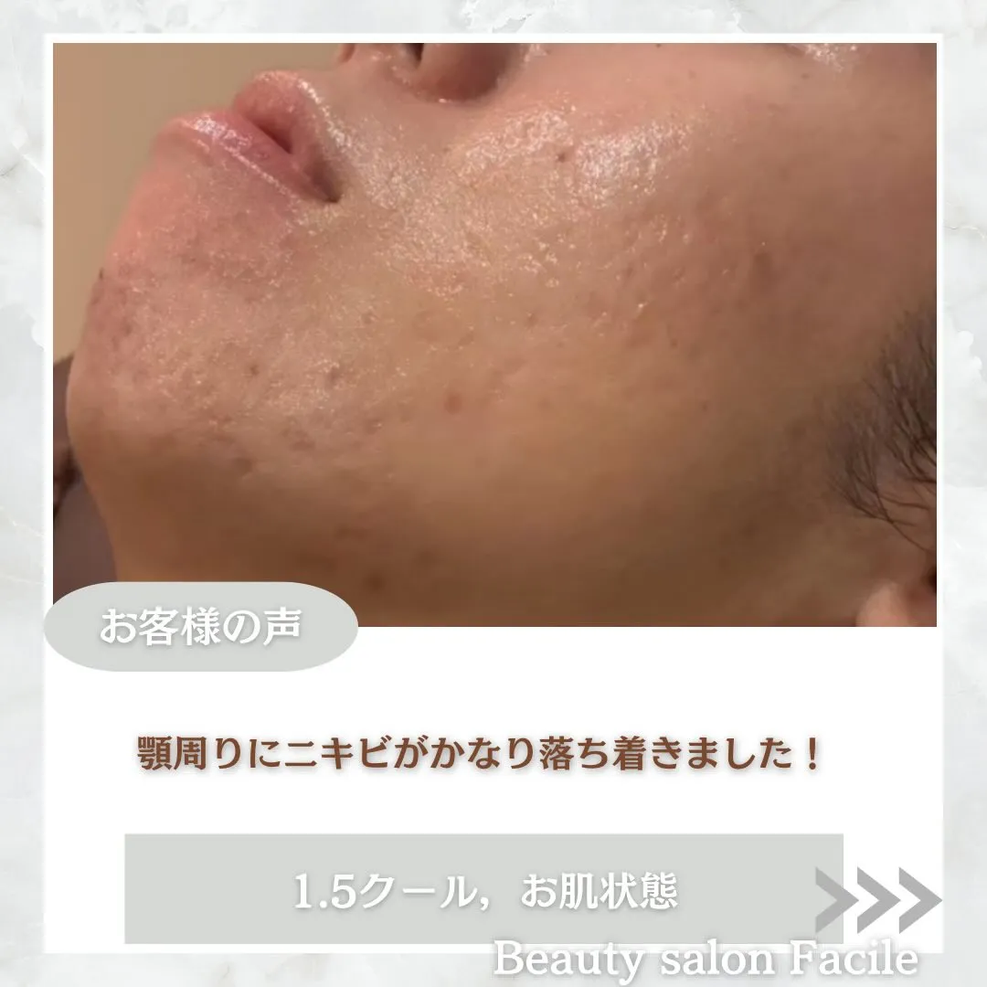 @beautysalonfacile 👈🏻他投稿もチェック