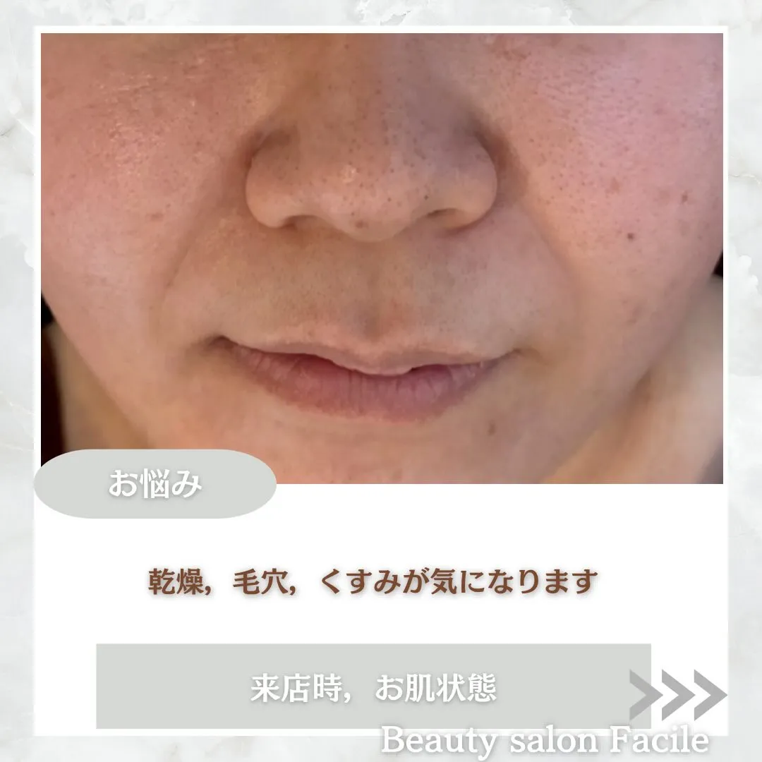 @beautysalonfacile 👈🏻他投稿もチェック
